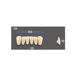 MFT 2M1 L33 Anterior x6