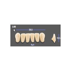 MFT 2M1 L40 Anterior x6