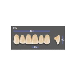 MFT 2M2 T46 Anterior x6