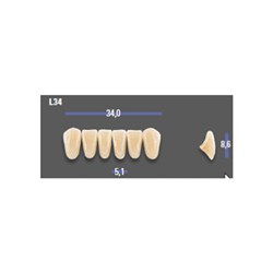 MFT 5M1 L34 Anterior x6