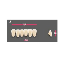 Vitapan Anterior Shade B4 Lower Mould L3 Set 6