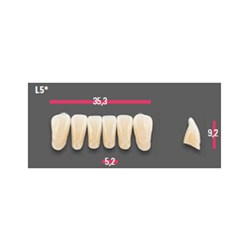 Vitapan Anterior Shade B4 Lower Mould L5 Set 6