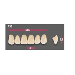 Vitapan Anterior Shade C1 Upper Mould T53 Set 6