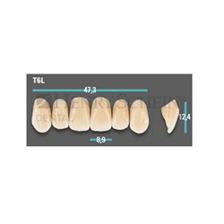 Physiodens Anterior Shade A1 Upper Mould T6L Set 6