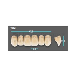 Physiodens Anterior Shade A2 Upper Mould T7M Set 6