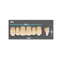 Physiodens Anterior Shade A2 Upper Mould X3L Set 6