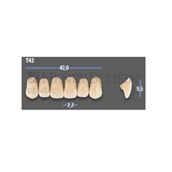 VITAPAN EXCELL Classical Upper Anterior Shade A1 Mould T42