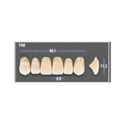 VITAPAN EXCELL Classical Upper Anterior Shade A35 Mould T48