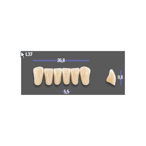 MFT 2L15 L37 Anterior x6