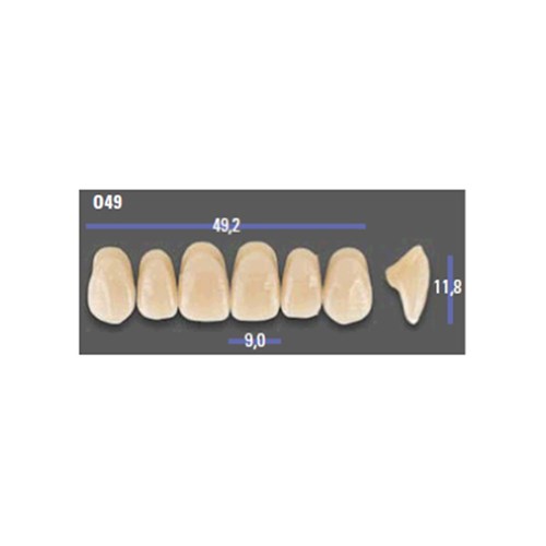 MFT 2L15 O49 Anterior x6