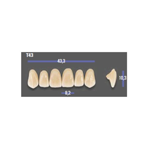 MFT 3M2 T43 Anterior x6