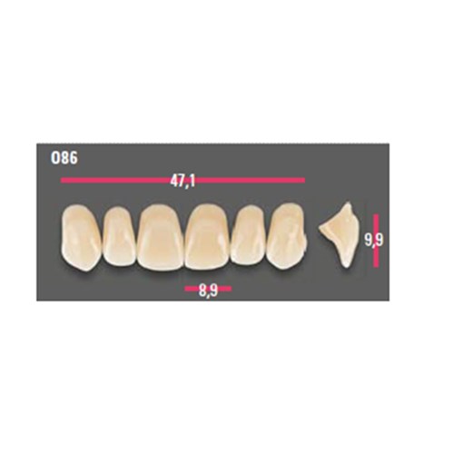 Vitapan Anterior Shade A1 Upper Mould O86 Set 6