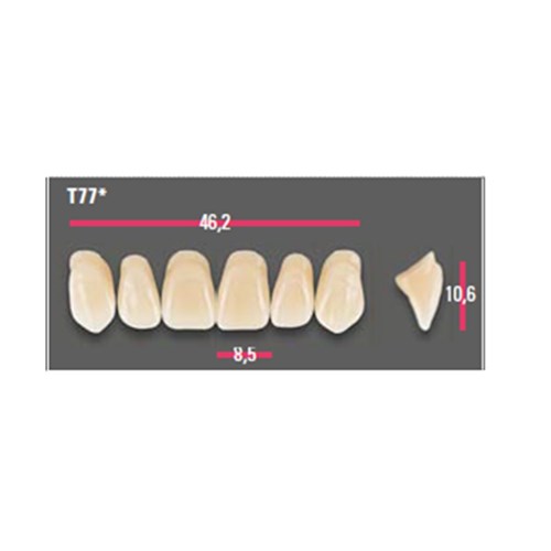 Vitapan Anterior Shade B2 Upper Mould T77 Set 6