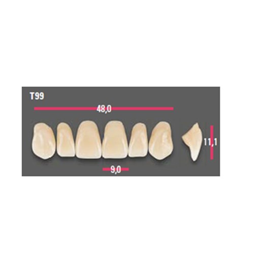 Vitapan Anterior Shade B3 Upper Mould T99 Set 6