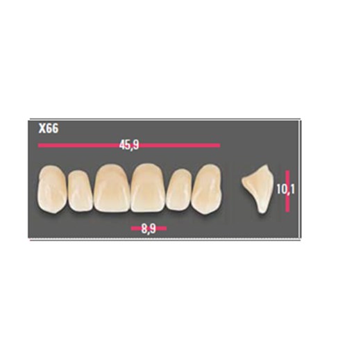 Vitapan Anterior Shade B4 Upper Mould X66 Set 6