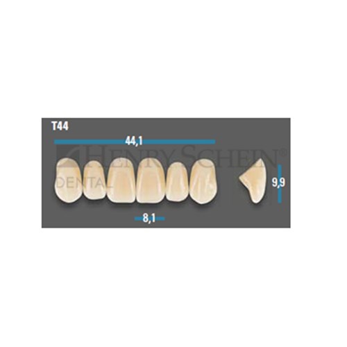 Vitapan Plus Anterior Shade D4 Upper Mould T44 Set 6