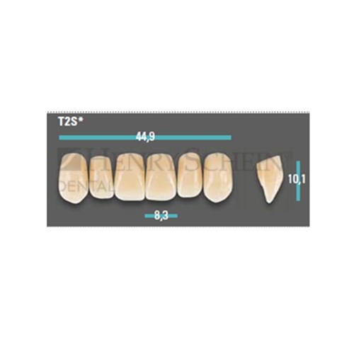 Physiodens Anterior Shade A1 Upper Mould T2S Set 6