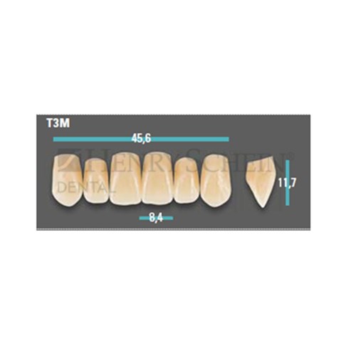 Physiodens Anterior Shade A1 Upper Mould T3M Set 6