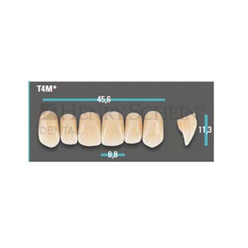 Physiodens Anterior Shade A1 Upper Mould T4M Set 6