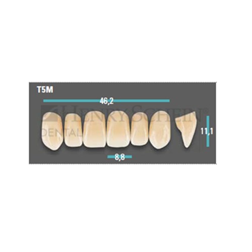 Physiodens Anterior Shade A1 Upper Mould T5M Set 6