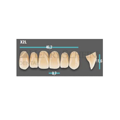 Physiodens Anterior Shade A1 Upper Mould X2L Set 6