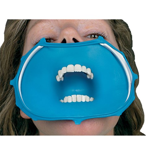 Optidam Intro Kit Anterior pkt 10