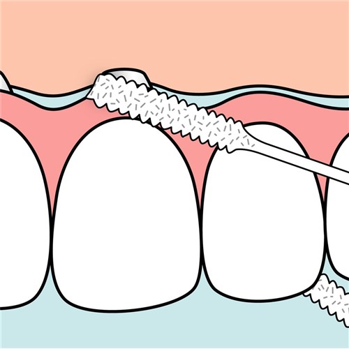 TePe Bridge & Implant Floss pkt 30